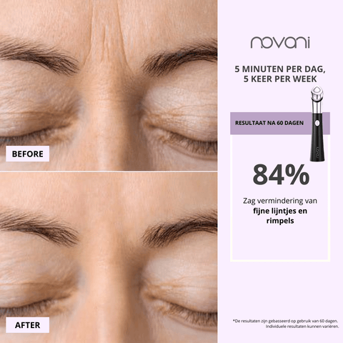 Age-R Booster 6-in-1 Anti-aging Device