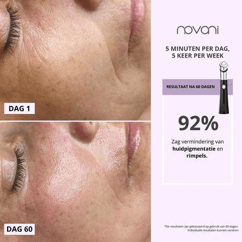 Age-R Booster 6-in-1 Anti-aging Device