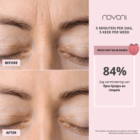 Skincare Novani