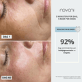 resultaat skincare