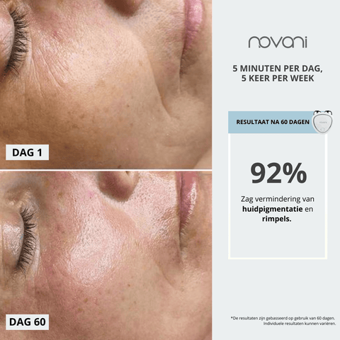 resultaat skincare