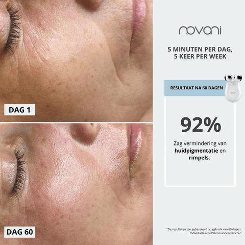 Bear Pro anti rimpel