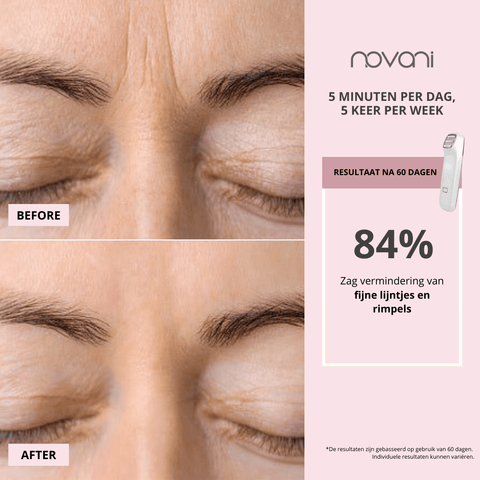 Face Revive Anti-rimpel Huidverjonging