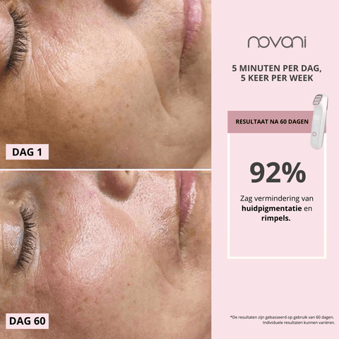Face Revive Anti-rimpel Huidverjonging