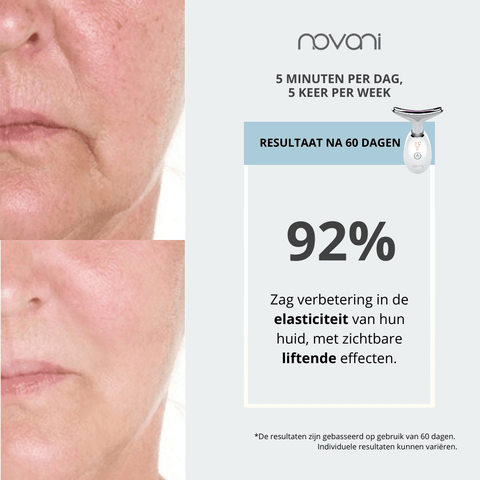 Anti Aging 